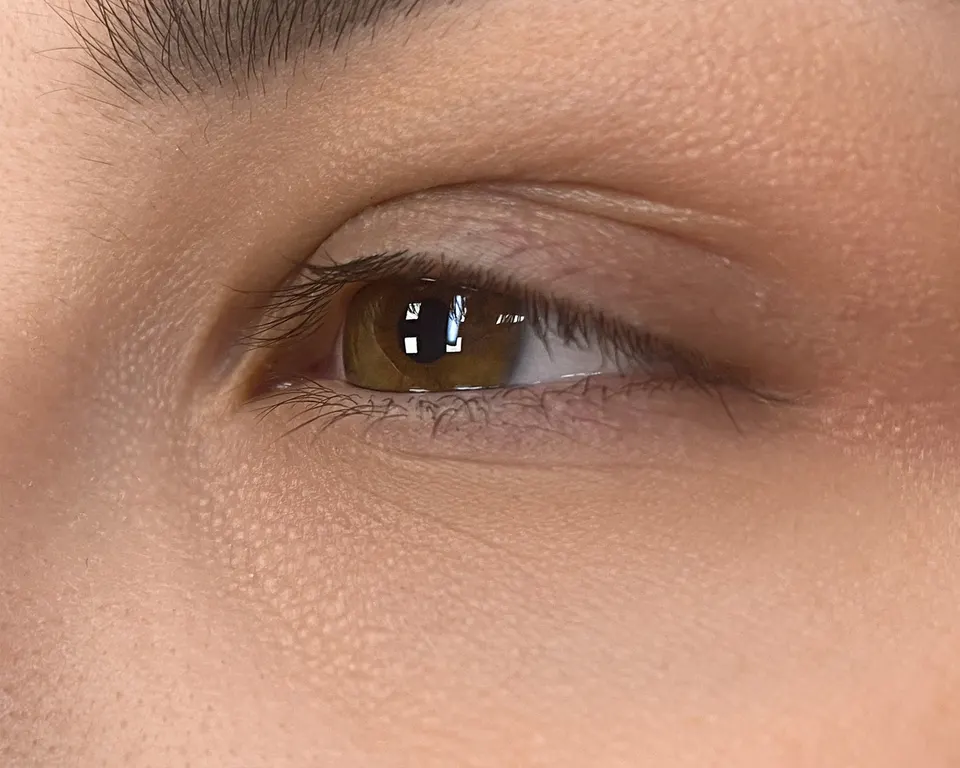 Lash line before the treatment
