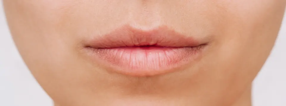Lips before the treatment
